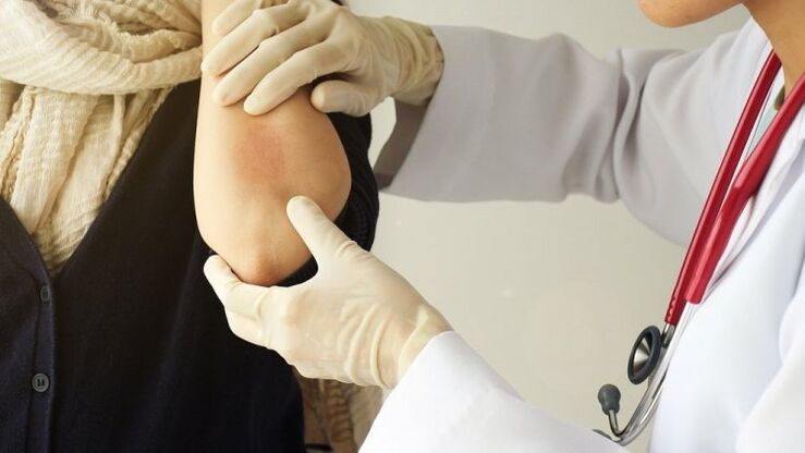 doctor examines elbow for psoriasis