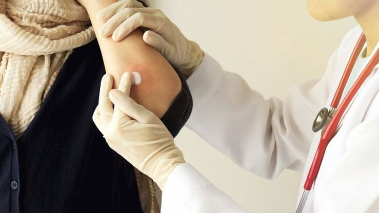 the doctor rubs the elbow for psoriasis